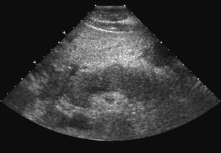 radiopaedia.com